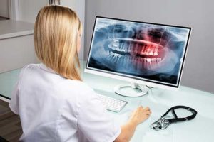 Dentist examining x-rays made with dental technology
