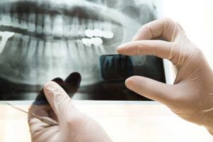 Dentist examining digital dental x-rays in Austin, Texas